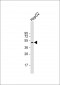 BCL6B Antibody (Center)